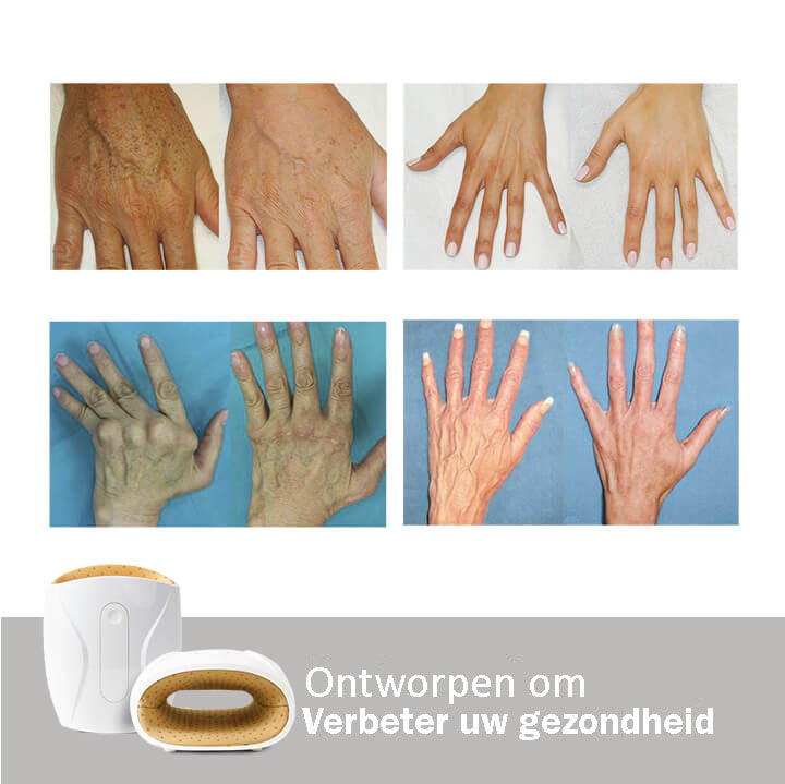 NuvitaPlus® Hand Masseur